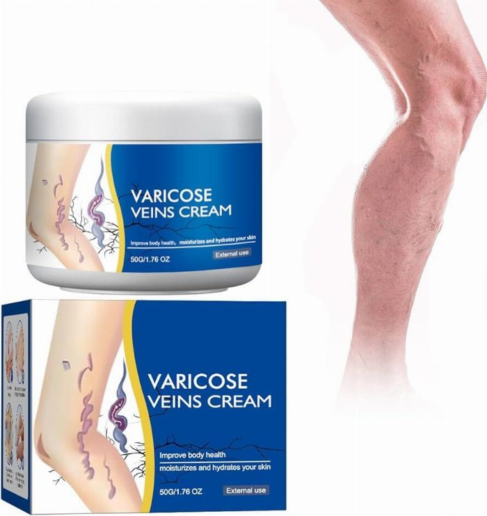 Creme para pernas com varices