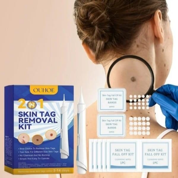 Kit para remover verrugas e acrocords