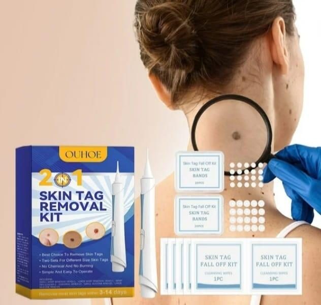Kit para remover verrugas e acrocords