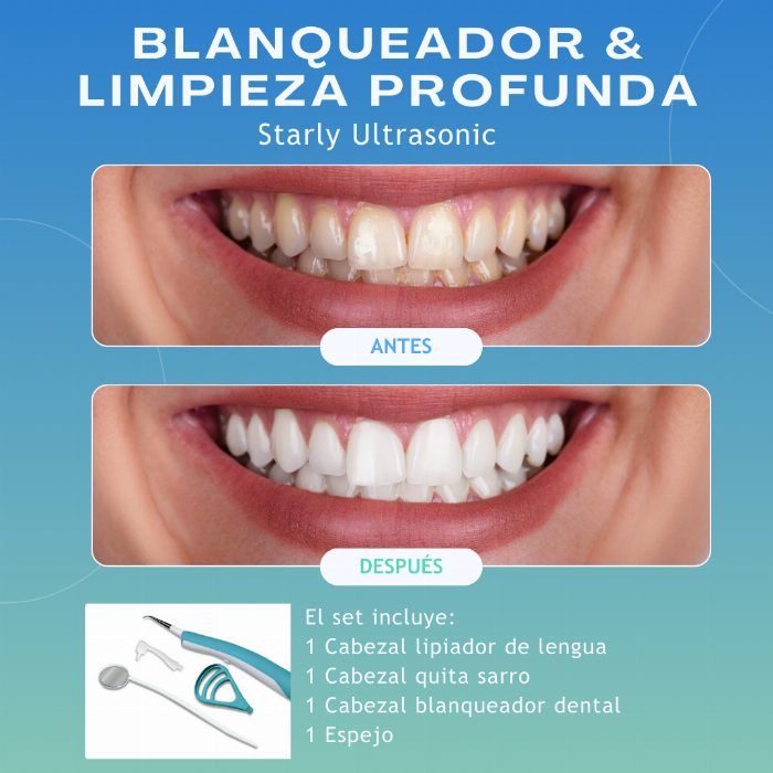 Limpeza dental de vibração de alta frequência - Bleach dental