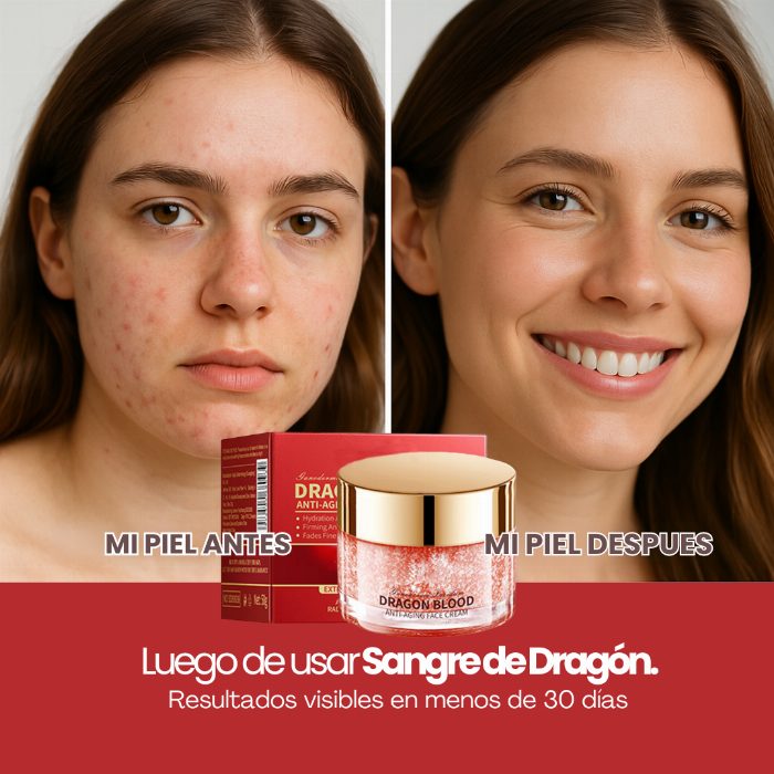 Creme de sangue de dragão